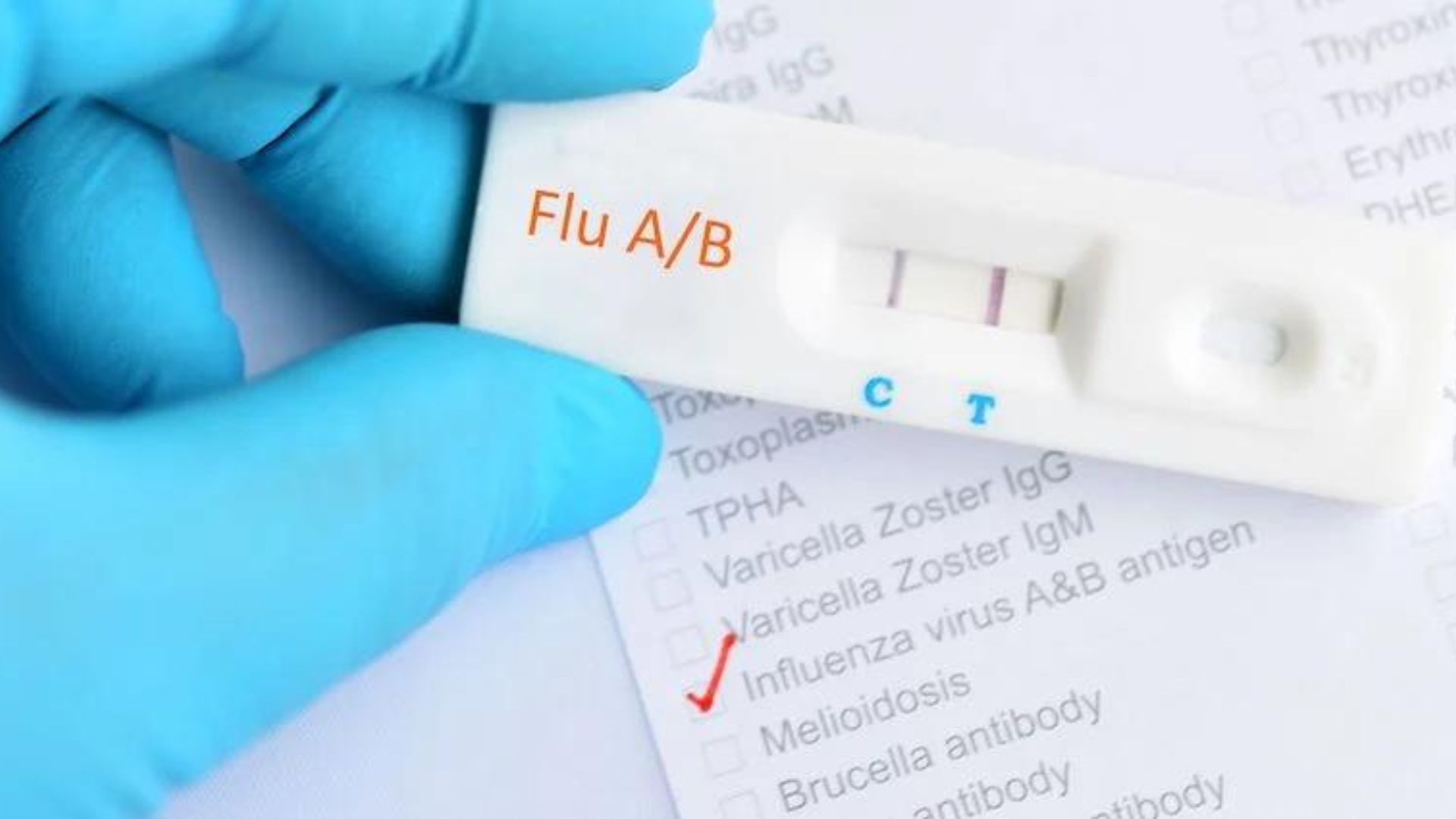 South Carolina is on the top of the list nationwide with highest number of flu cases in recent weeks, a trend expected to continue